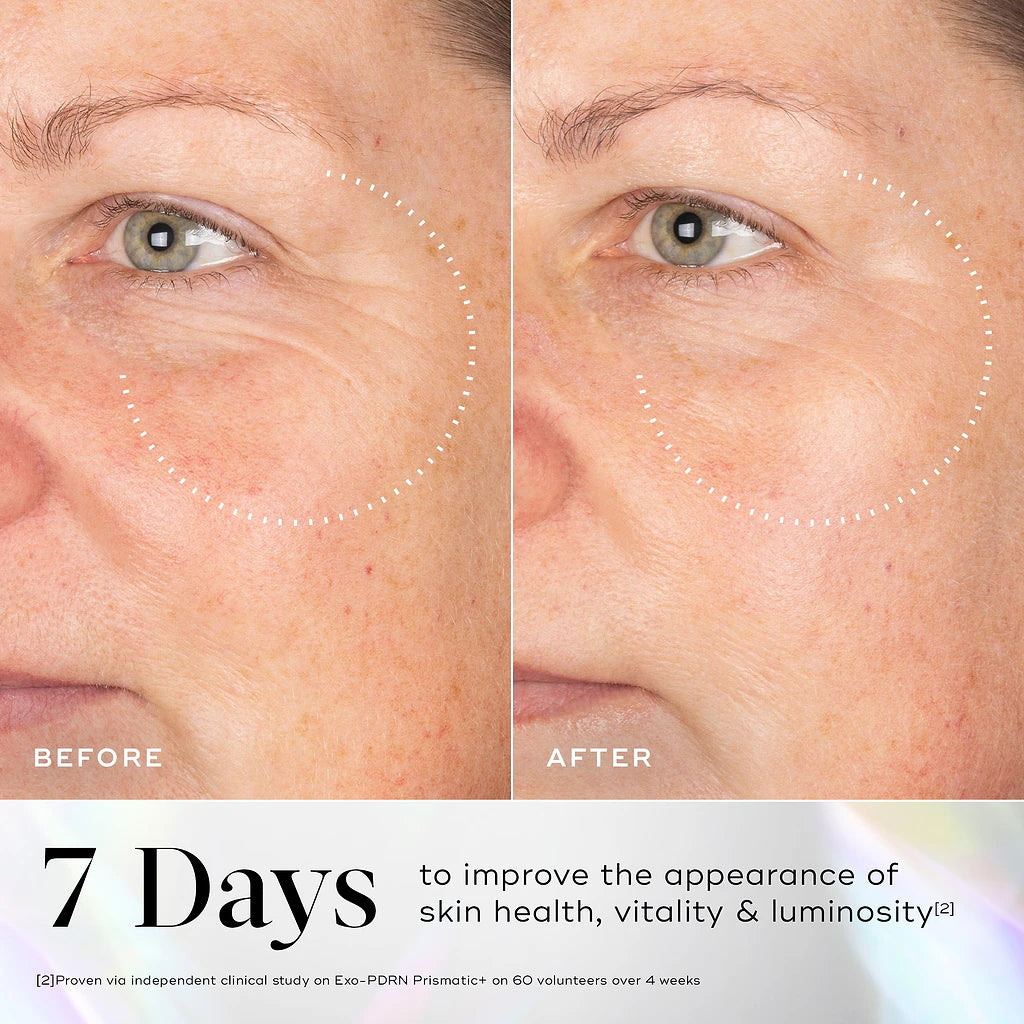 Age-Defying Exosome Serum