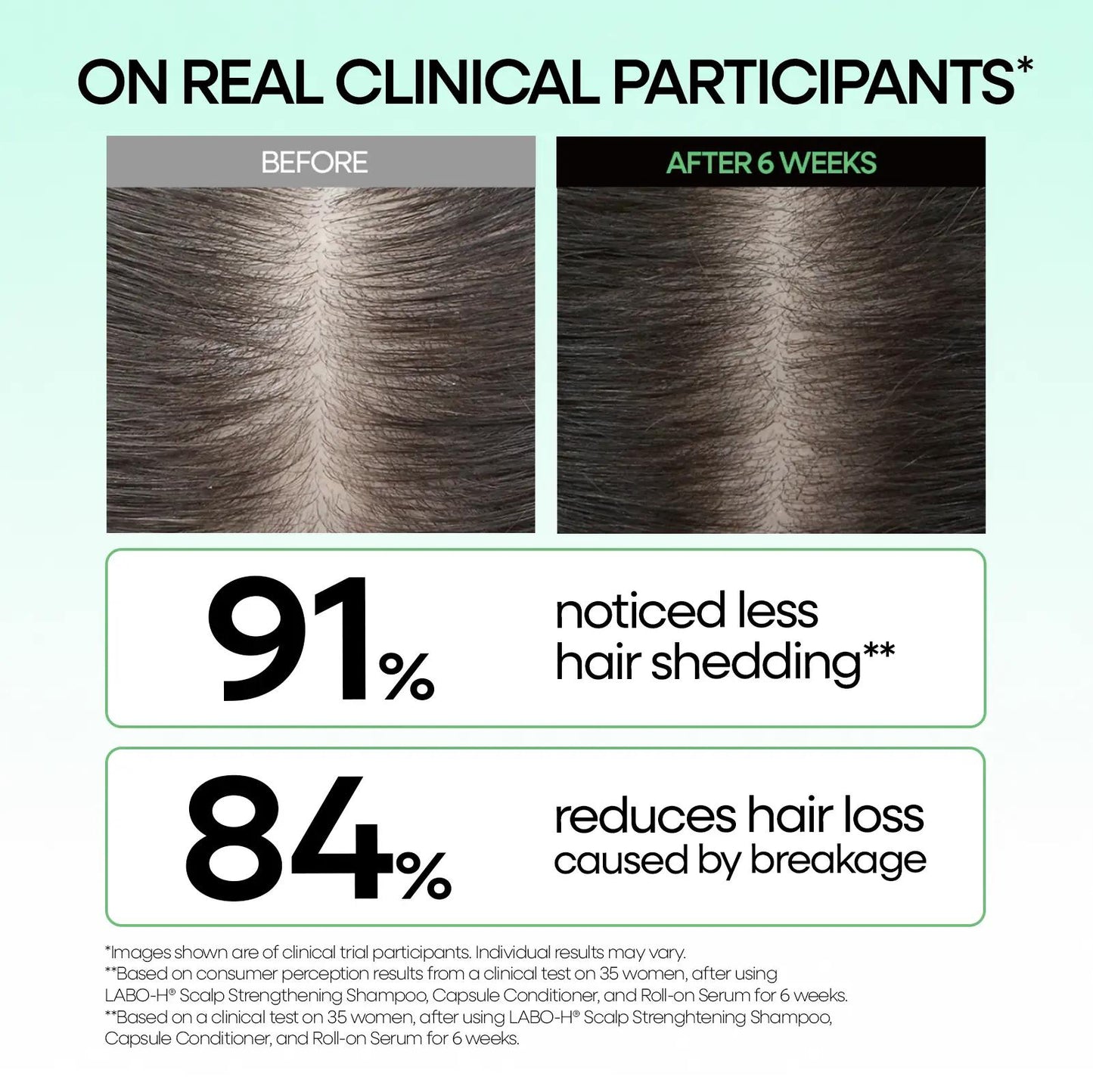 LABO-H Scalp Strengthening Roll-on Serum