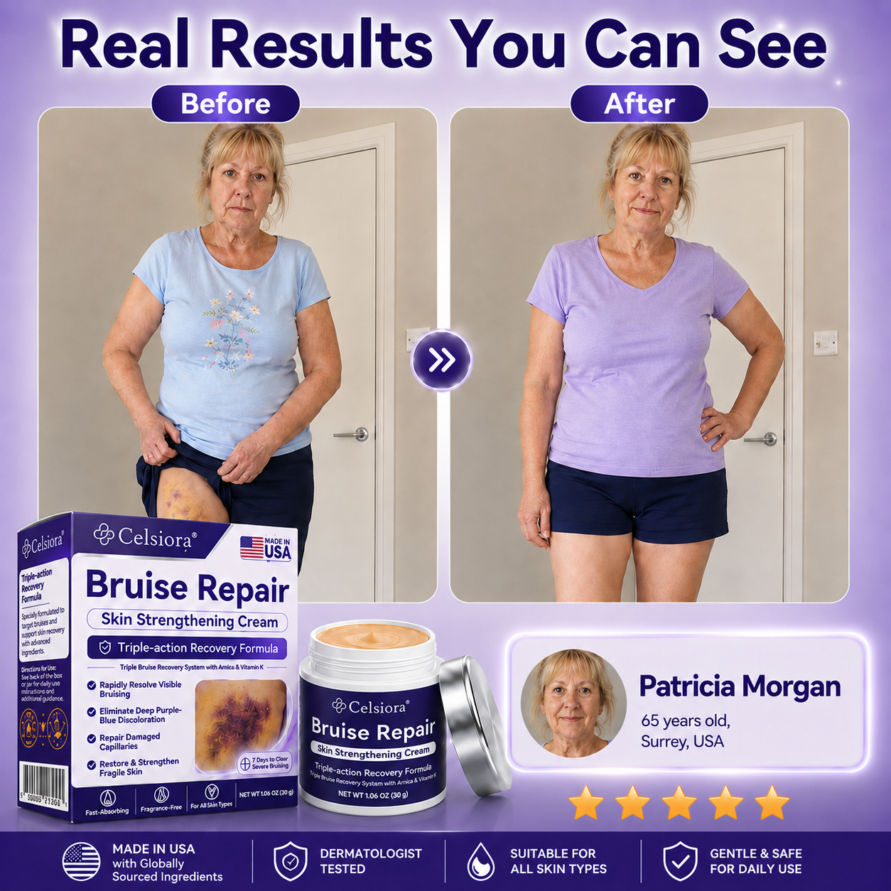 Rolimey® cream to repair bruises and strengthen the skin.