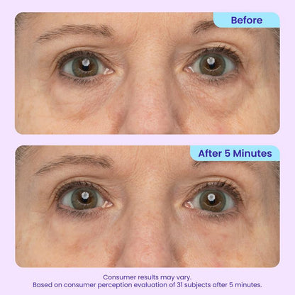NEW! Instant Lift Eye Gel