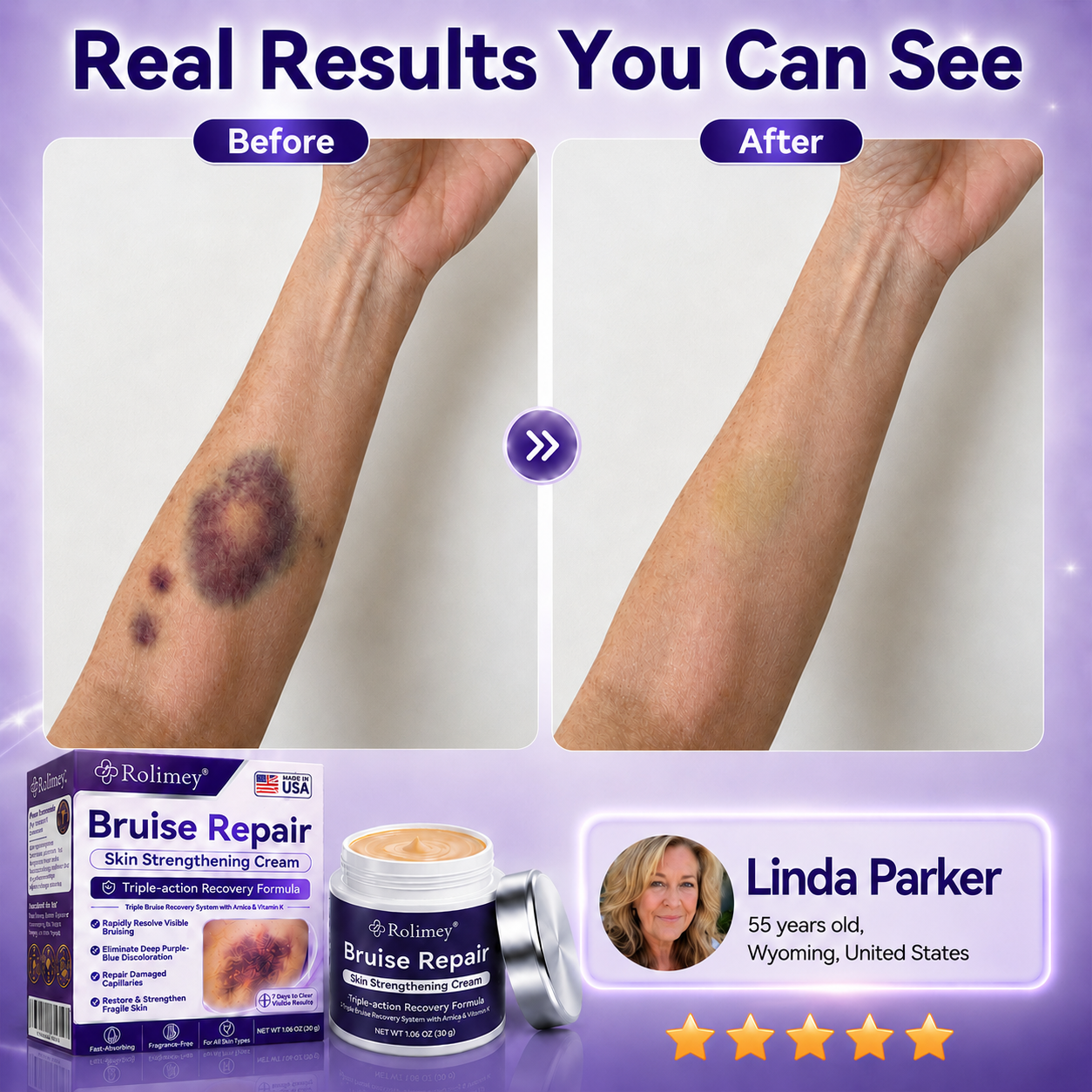 Rolimey® cream to repair bruises and strengthen the skin.