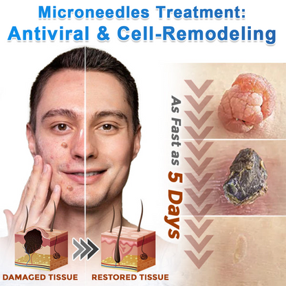 Celsiora® 2-in-1 Microneedle & Hydrocolloid Patch