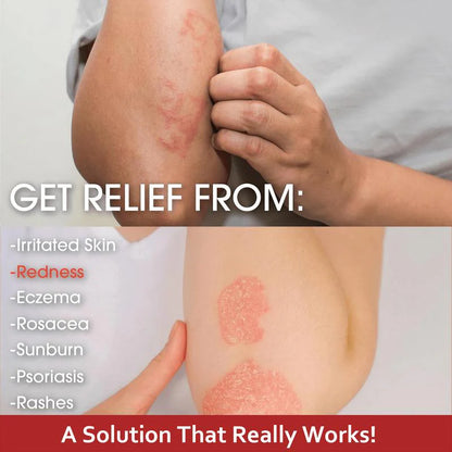 Herbal Skin Restore Sensitive Skin Relief Cream