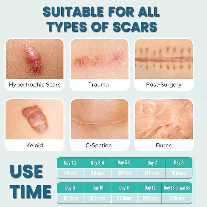 Silicone Scar Removal Tape