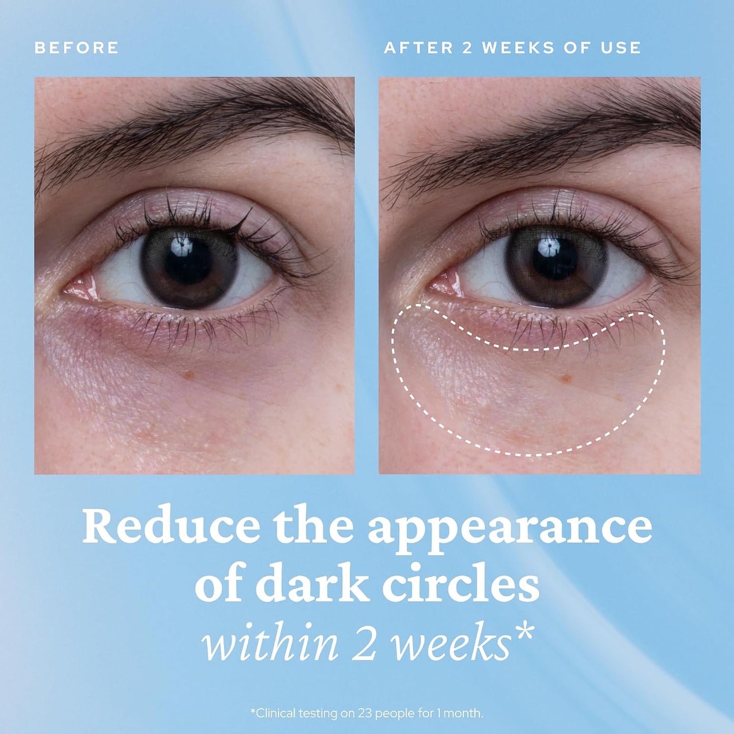 Bleu Venus® Caffeine Eye Gel — Hydrating & De-Puffing with Cooling Applicator