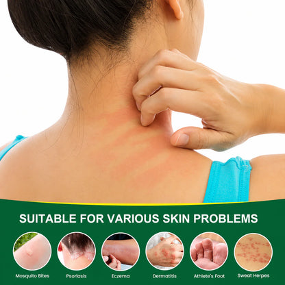 Herbal Skin Restore Sensitive Skin Relief Cream
