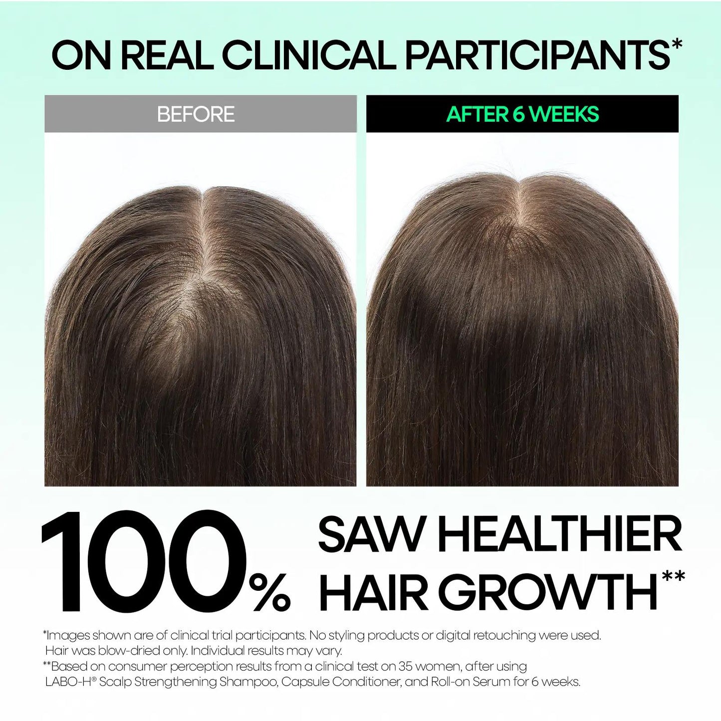 LABO-H Scalp Strengthening Roll-on Serum