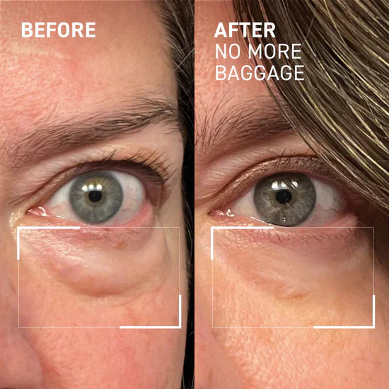 Firming & Wrinkle Removal Stick | Anti-aging, Sagging, Wrinkles