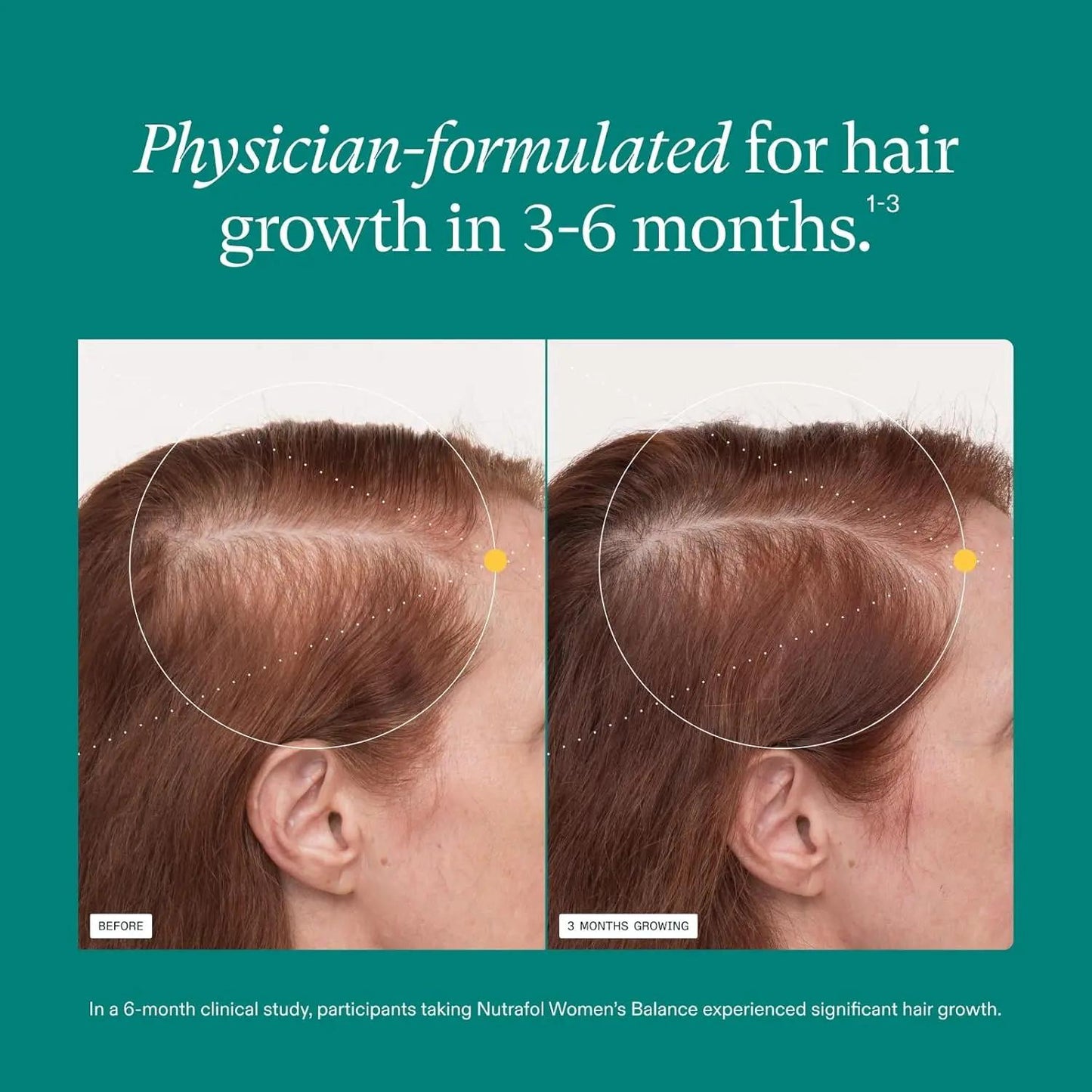 Nutrafol Women's Balance Ages 45 and Up Hair Growth Supplements