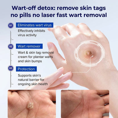 Healrize® 🖊 Advanced Wart & Skin Tag Removal Pen