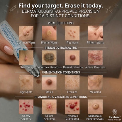 Healrize® 🖊 Advanced Wart & Skin Tag Removal Pen