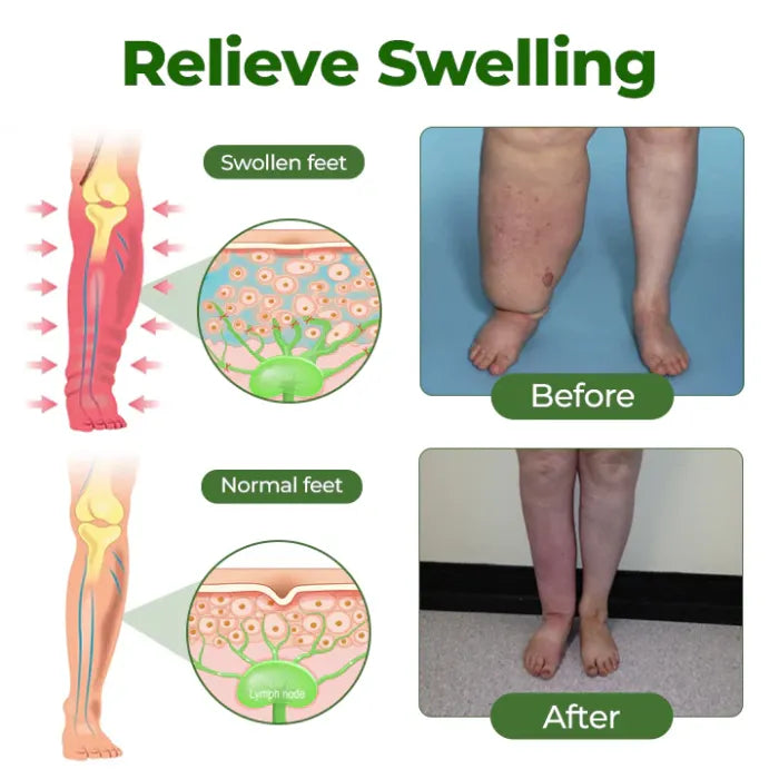 VIXIRUS® Professional Leg Circulation Cream