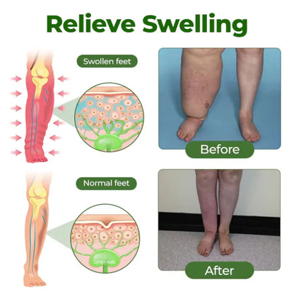 VIXIRUS® Professional Leg Circulation Cream