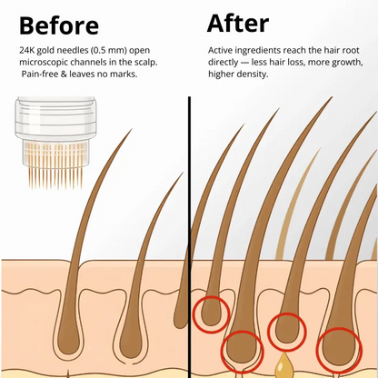 Apex Hair Regrowth System