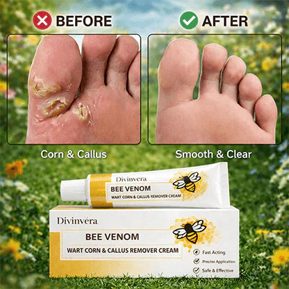 The Promise: Sandal Confidence Again